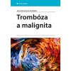 Elektronická kniha Trombóza a malignita - Jana Hirmerová