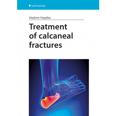 Treatment of calcaneal fractures - Popelka Vladimír