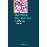 Neinvazivní karcinomy prsu - Pavlišta David a kolektiv – Hledejceny.cz