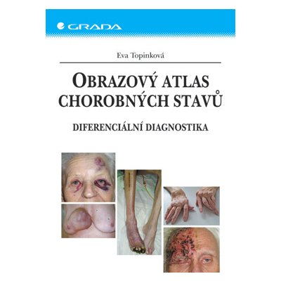 Obrazový atlas chorobných stavů - Topinková Eva