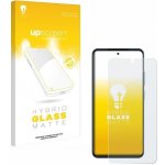 FIXED Full-Cover na Xiaomi Redmi Note 11 černé FIXGFA-932-BK – Zboží Mobilmania