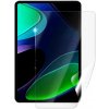 Ochranná fólie pro tablety Screenshield XIAOMI Pad 6 fólie na displej XIA-P6-D