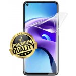 Ochranná fólie Hydrogel Xiaomi Redmi Note 9 5G – Zboží Mobilmania