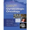 Kniha Principles and Practice of Gynecologic Oncology