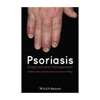 Psoriasis