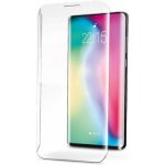 Aligator Xiaomi Mi 11, černá GLF0023 – Zboží Živě