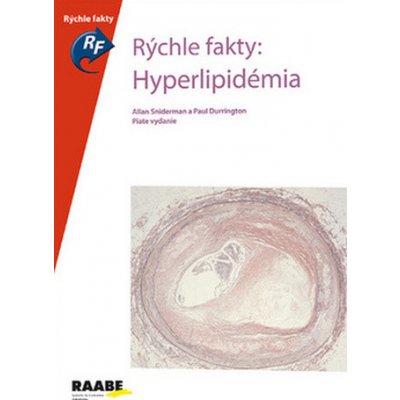 Hyperlipidémia - Allan Sniderman, Paul Durrington – Zboží Mobilmania
