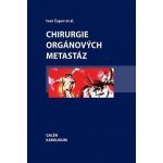 Chirurgie orgánových metastáz – Hledejceny.cz