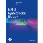 MRI of Gynaecological Diseases: Illustrations and Cases Zhang GuofuPevná vazba – Zbozi.Blesk.cz