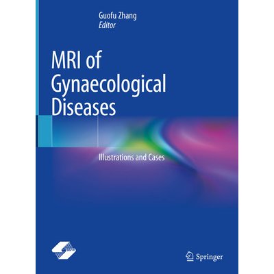 MRI of Gynaecological Diseases: Illustrations and Cases Zhang GuofuPevná vazba – Zbozi.Blesk.cz