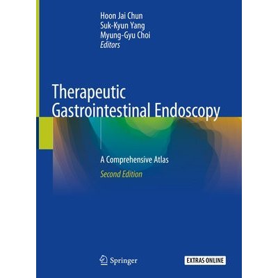Therapeutic Gastrointestinal Endoscopy – Zbozi.Blesk.cz