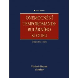 Onemocnění temporomandibulárního kloubu - diagnostika a léčba - Vladimír Machoň