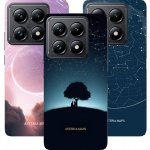 AsteriaMaps Kryt na Xiaomi 14T Pro s vlastní hvězdnou mapou – Hledejceny.cz