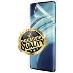 Ochranná fólie Hydrogel Xiaomi Mi 11 Ultra – Zbozi.Blesk.cz