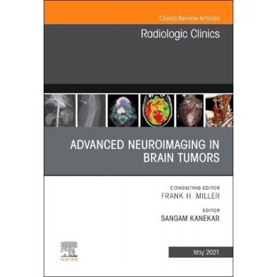 Advanced Neuroimaging in Brain Tumors, An Issue of Radiologic Clinics of North America