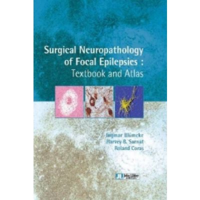 Surgical Neuropathology of Focal Epilepsies – Zbozi.Blesk.cz