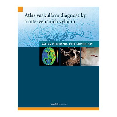 Atlas vaskulární diagnostiky a intervenčních výkonů - Procházka Václav, Novobilský Petr