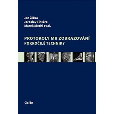 Protokoly MR zobrazování. Pokročilé techniky - Jan Žižka, Jaroslav Tintěra – Hledejceny.cz