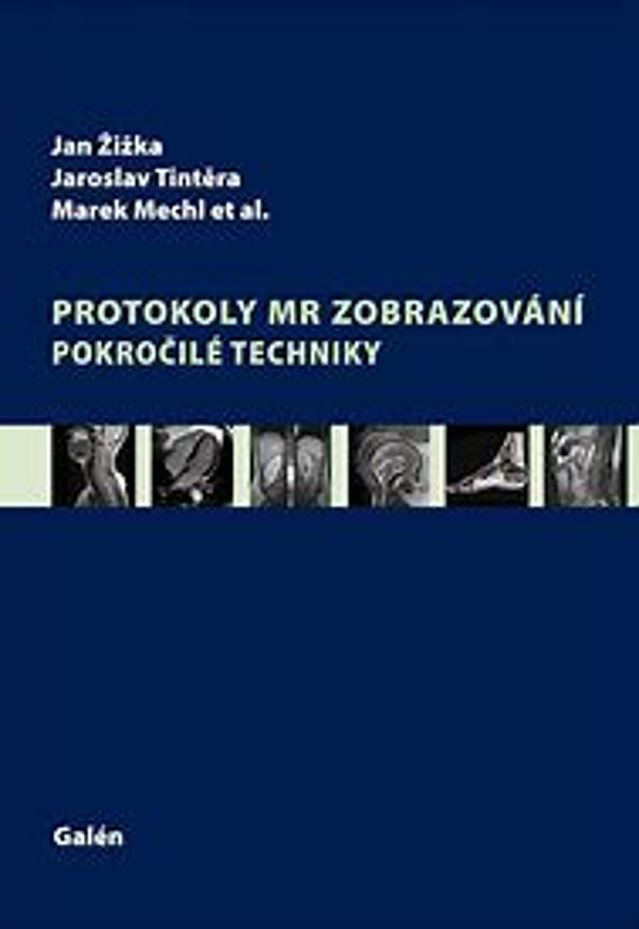 Protokoly MR zobrazování. Pokročilé techniky - Jan Žižka, Jaroslav Tintěra