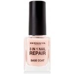 Dermacol Zpevňovač na nehty 3in1 Nail Repair 11 ml – Sleviste.cz