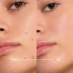 Bioderma Sébium Kerato+ Pleťový krém na akné 30 ml – Zboží Dáma