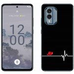 mmCase na Nokia X30 5G - srdce a tep černé pozadí – Zboží Mobilmania