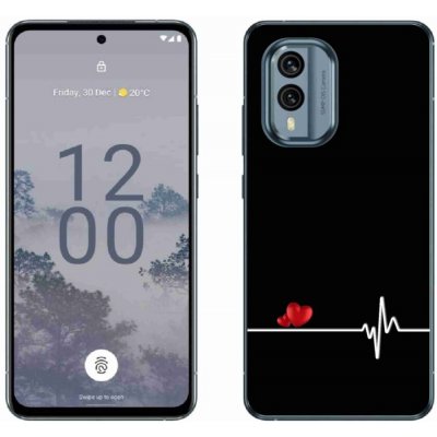 mmCase na Nokia X30 5G - srdce a tep černé pozadí – Zboží Mobilmania