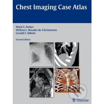 Chest Imaging Case Atlas - Mark S. Parker – Hledejceny.cz