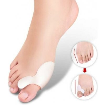 Medical Brace Silikonový korektor vbočeného palce – Zboží Dáma