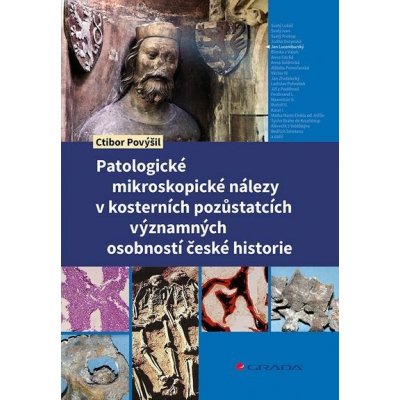 Patologické mikroskopické nálezy v kosterních pozůstatcích významných osobností české historie e-kn