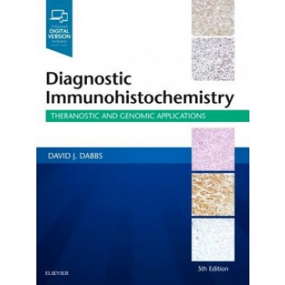 Diagnostic Immunohistochemistry Kniha – Hledejceny.cz
