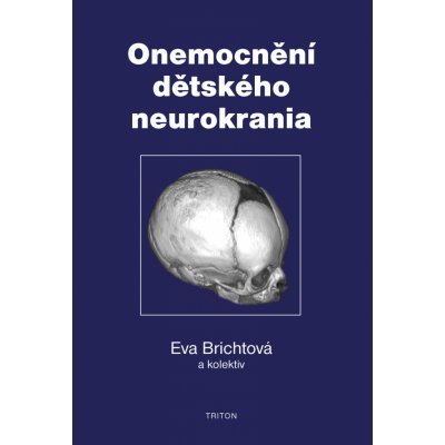 Onemocnění dětského neurokrania - Eva Brichtová – Hledejceny.cz