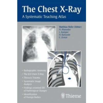 Chest X-ray Trainer