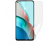 Ochranná fólie Screenshield XIAOMI Mi 11 Lite 4G - displej – Sleviste.cz