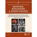 Rinitidy, sinusitidy a nosní polypy – Hledejceny.cz