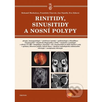 Rinitidy, sinusitidy a nosní polypy – Hledejceny.cz