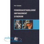 Femoroacetabul ární impingement syndrom – Sleviste.cz