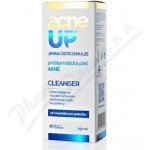 AcneUP cleanser jemná čistící emulze 250 ml – Zboží Mobilmania