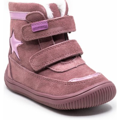 Protetika Linet růžová – Hledejceny.cz