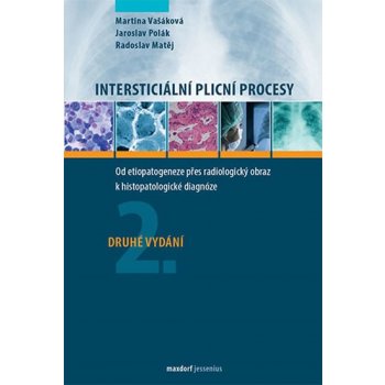 Intersticiální plicní procesy - Od etiopatogeneze přes radiologický obraz k histopatologické diagnóze - Vašáková Martina, Polák Jaroslav, Matěj Radoslav