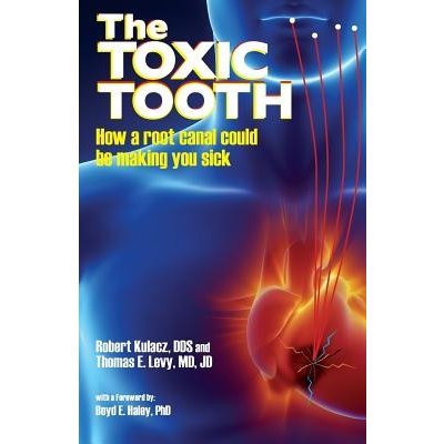 The Toxic Tooth: How a Root Canal Could Be Making You Sick Kulacz Dds RobertPaperback