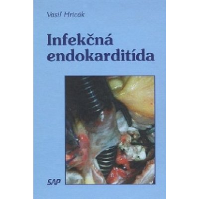 Infekčná endokarditída – Hledejceny.cz