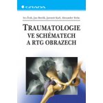 Traumatologie ve schématech a RTG obrazech - Žvák Ivo, Brožík Jan, Kočí Jaromír, Ferko Alexander – Zboží Dáma