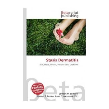 Stasis Dermatitis