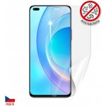 Ochranná fólie ScreenShield HUAWEI Honor 50 lite - displej – Zbozi.Blesk.cz