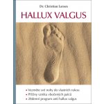 Hallux valgus - Larsen Christian – Hledejceny.cz