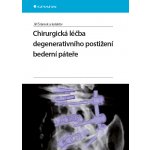 Chirurgická léčba degenerativního postižení bederní páteře – Sleviste.cz