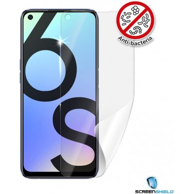 Ochranná fólie Screenshield Realme 6s - displej – Zboží Mobilmania