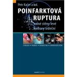 Poinfarktová ruptura - Petr Kačer – Zbozi.Blesk.cz
