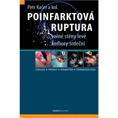 Poinfarktová ruptura - Petr Kačer